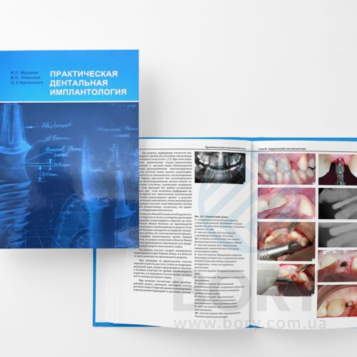 Книжка – Практична дентальна імплантологія – керівництво. Мушеєв І.У. 2008.