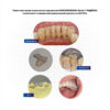 Шинуюча стрічка Підвязка світлозатверджуване Кевларволокно Kevlar Dental Fibres Arkona 10см x 2мм, шт 9414